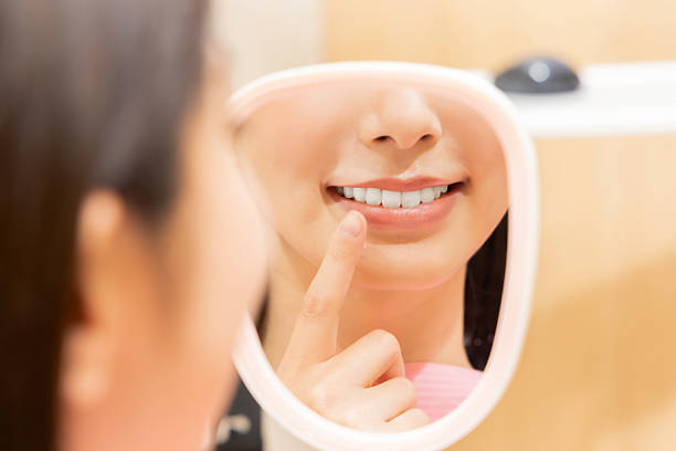 Affordable Dental Veneers solutions in San Diego, CA